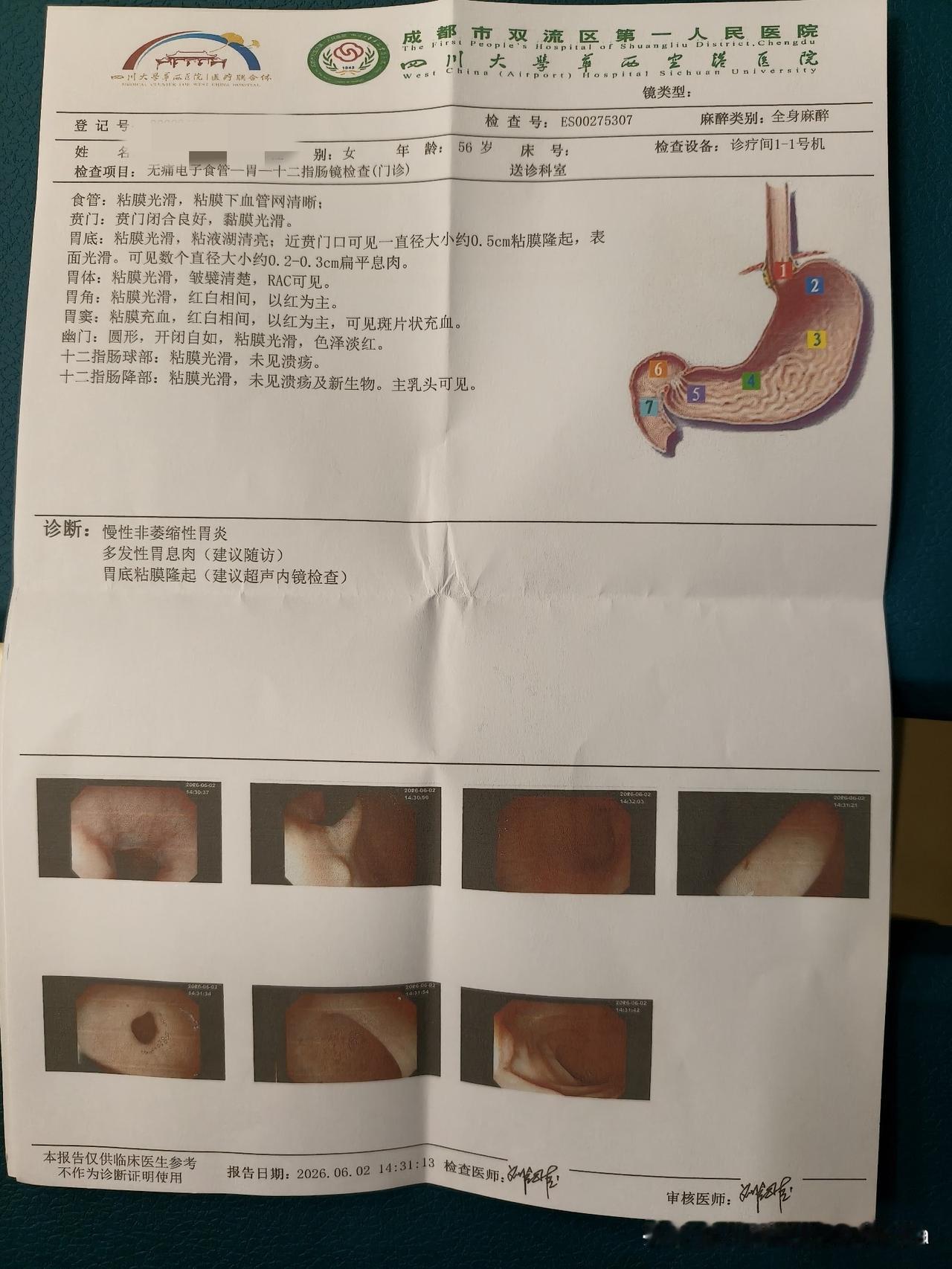 不会下棋，还是来摆会龙门阵吧？懂的朋友帮我看看，我这个是什么瘤子？

今天去做了