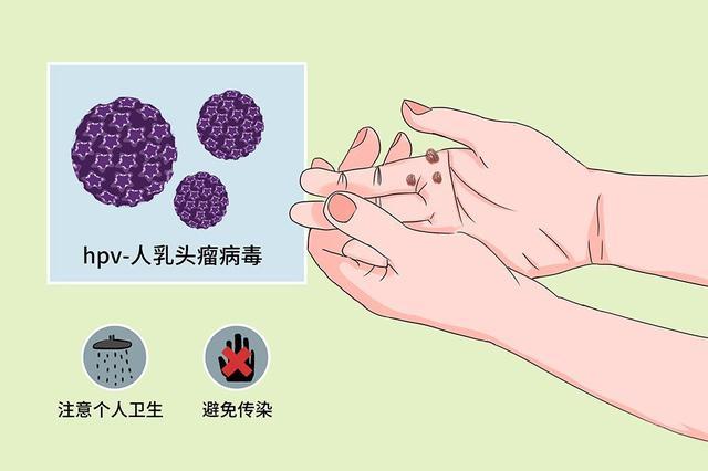 #健康真探社#【身上这些皮肤问题，说明你可能感染了hpv！】提起HPV（人乳头瘤