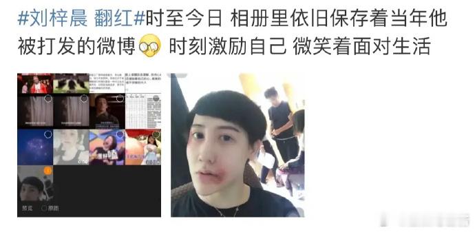 这是什么刘梓晨黑历史回顾，网友把他以前被嘿粉打的视频翻出来了[允悲]不过刘梓晨现
