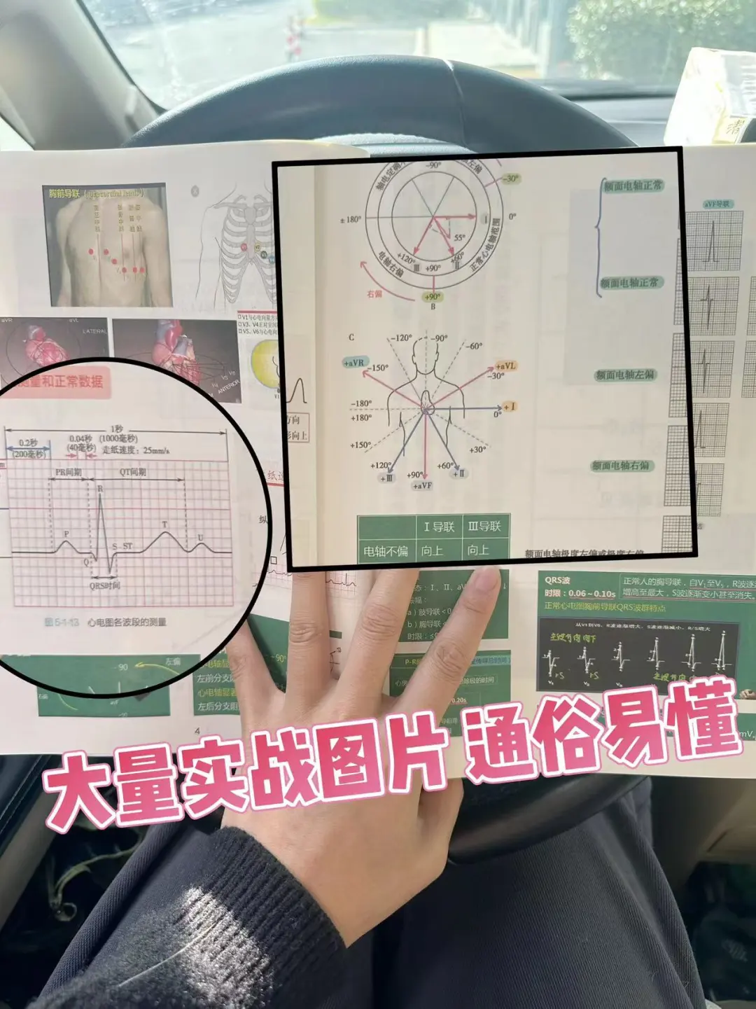 医学生心电图看懂版