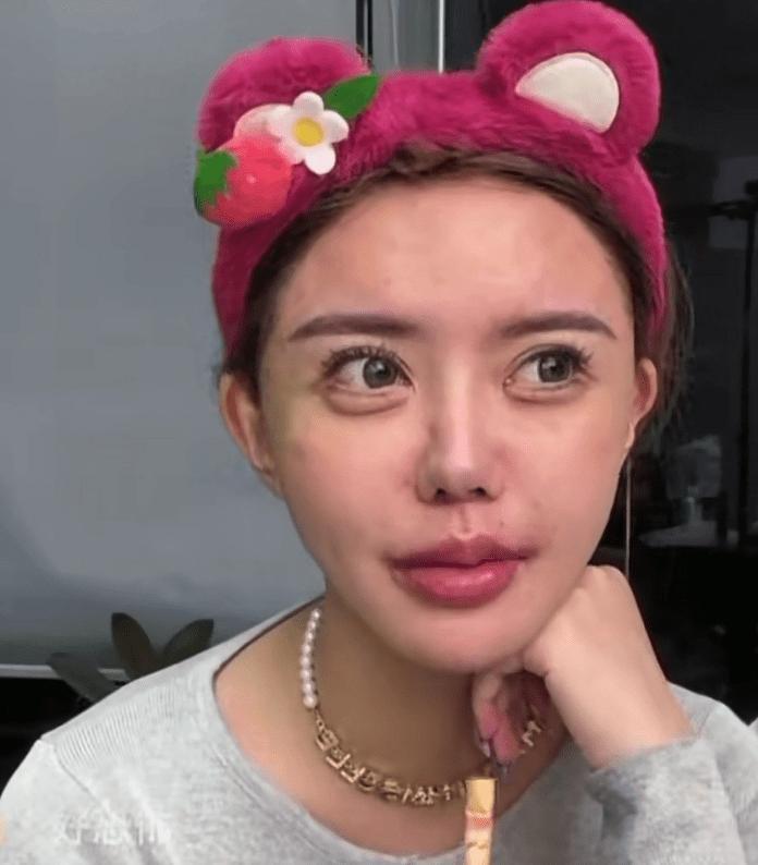 医美直播间里，大家最爱看的是变美前后对比，最容易忽略的却是手术台上的风险。近日，