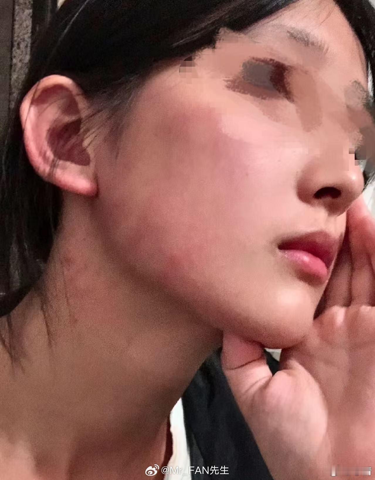 我被室友打耳光，还手后被她殴打被迫下跪 