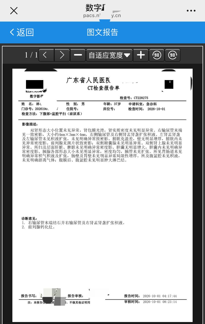 输尿管排出结石后，左右两个腰子大多时间体感一致已经持续了差不多十六个小时，状态好