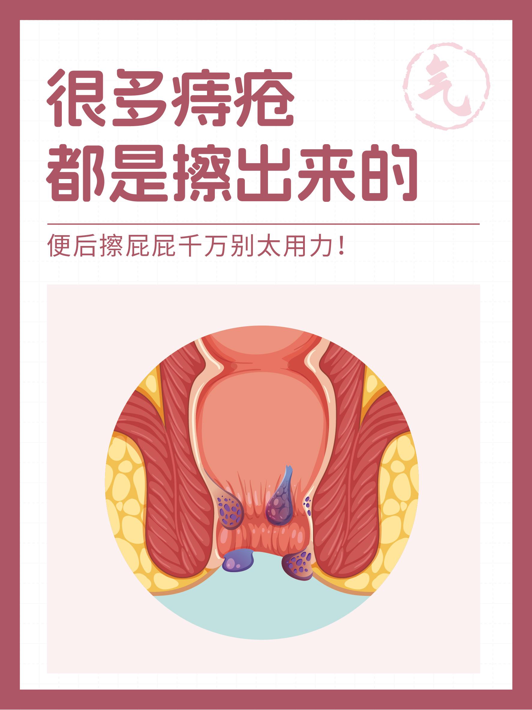 便后擦屁屁，别太用力！！！