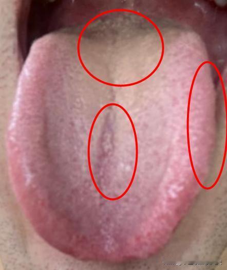 失眠多梦、四肢乏力？送你1盒中成药，清肝火、祛湿热、补脾肾
这位粉丝最近感觉食欲