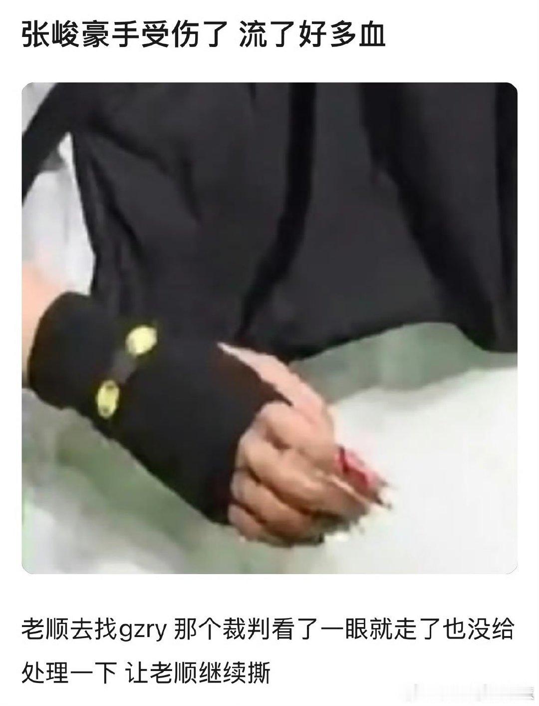 张峻豪手受伤流血张峻豪疑似手受伤流血 张峻豪疑似手受伤流血，还好吗 
