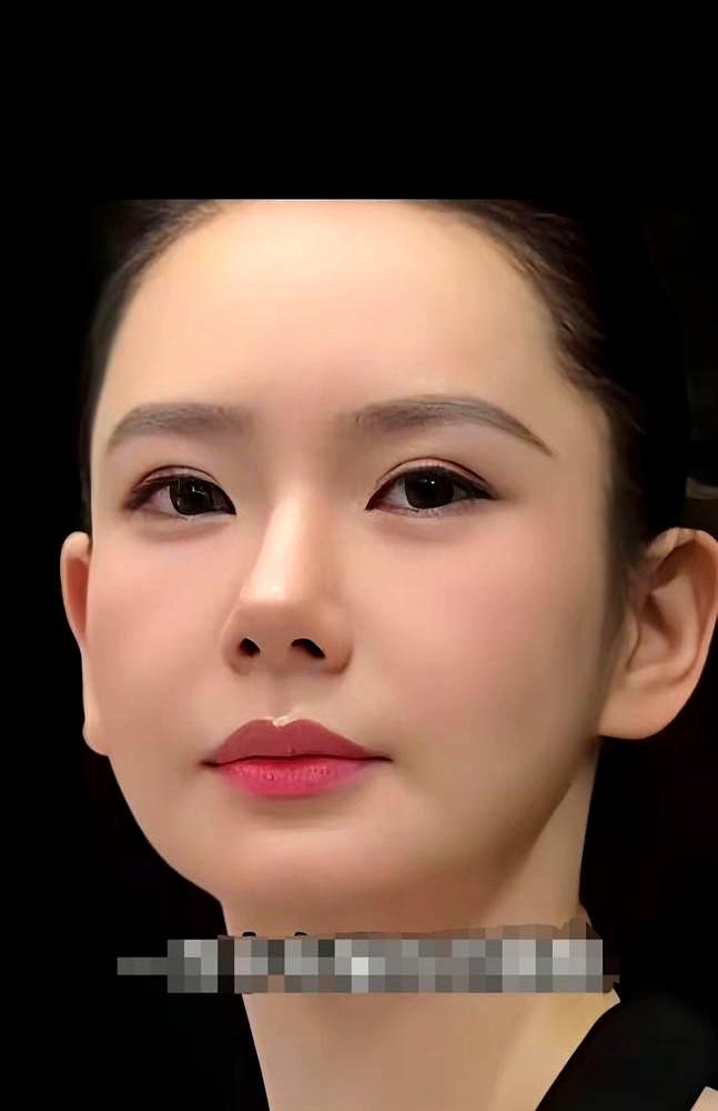 戚薇又上热搜了。这次不是秀恩爱，是脸僵成馒头，眉毛动不了。
 

她直播掀刘海：