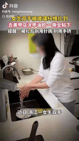 浙江，一女生不小心被玻璃纤维扎满手，又刺又痒看不见，没想到她没去医院，也没拿针乱