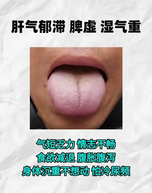 继续舌苔辨证！你发我看，直出结果！