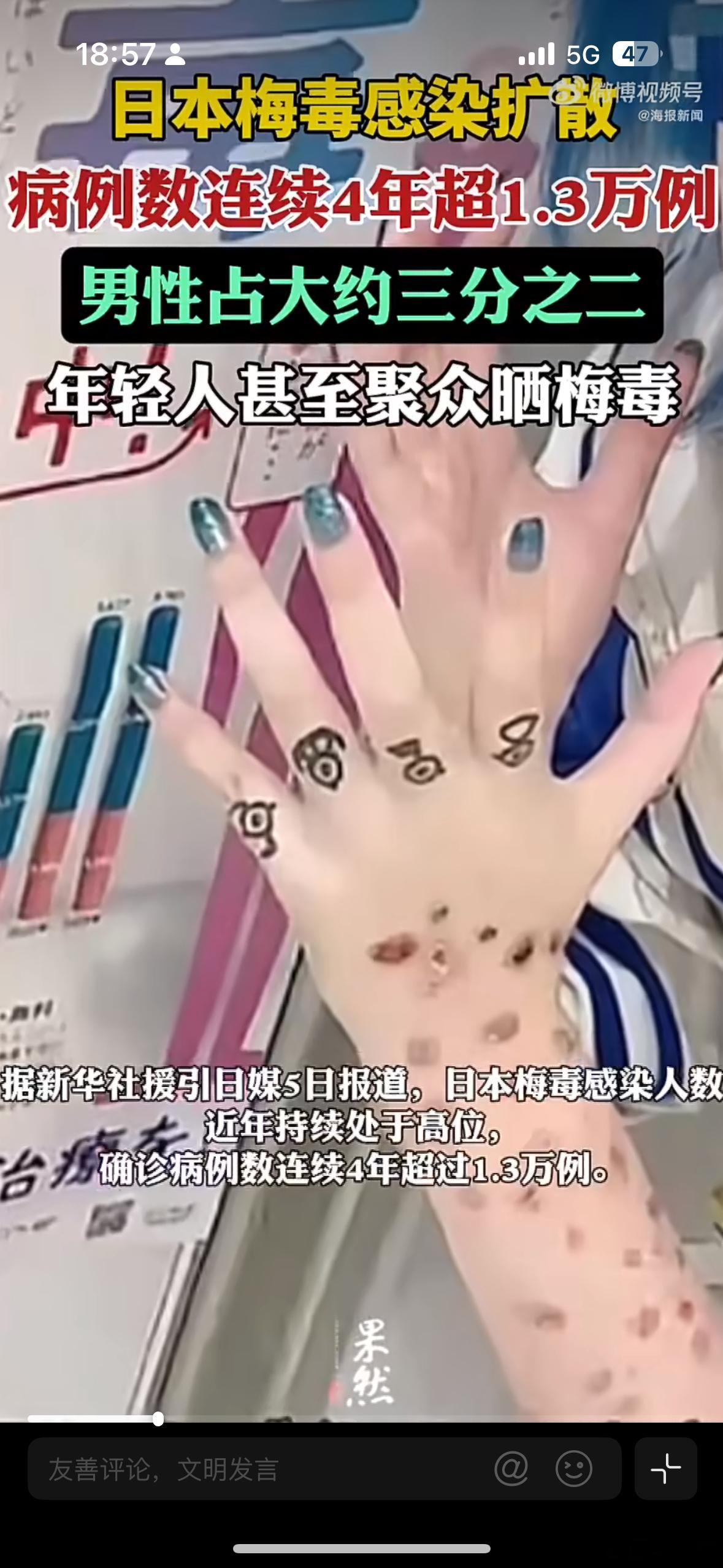 日本年轻人聚众晒梅毒666还有高手，怪不得说还是岛国会玩啊