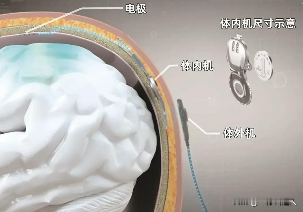 如果说脑机接口，类似数据线，那么蓝牙对应哪种技术呢？