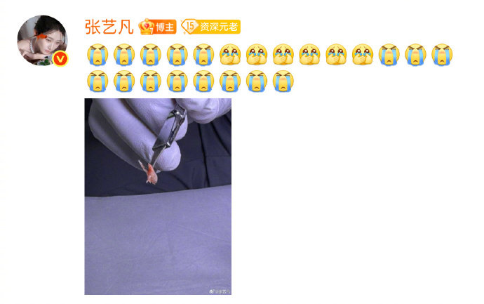 张艺凡自曝患甲沟炎 张艺凡空降超话聊起自己患甲沟炎的经历，隔着屏幕都能感受好疼！
