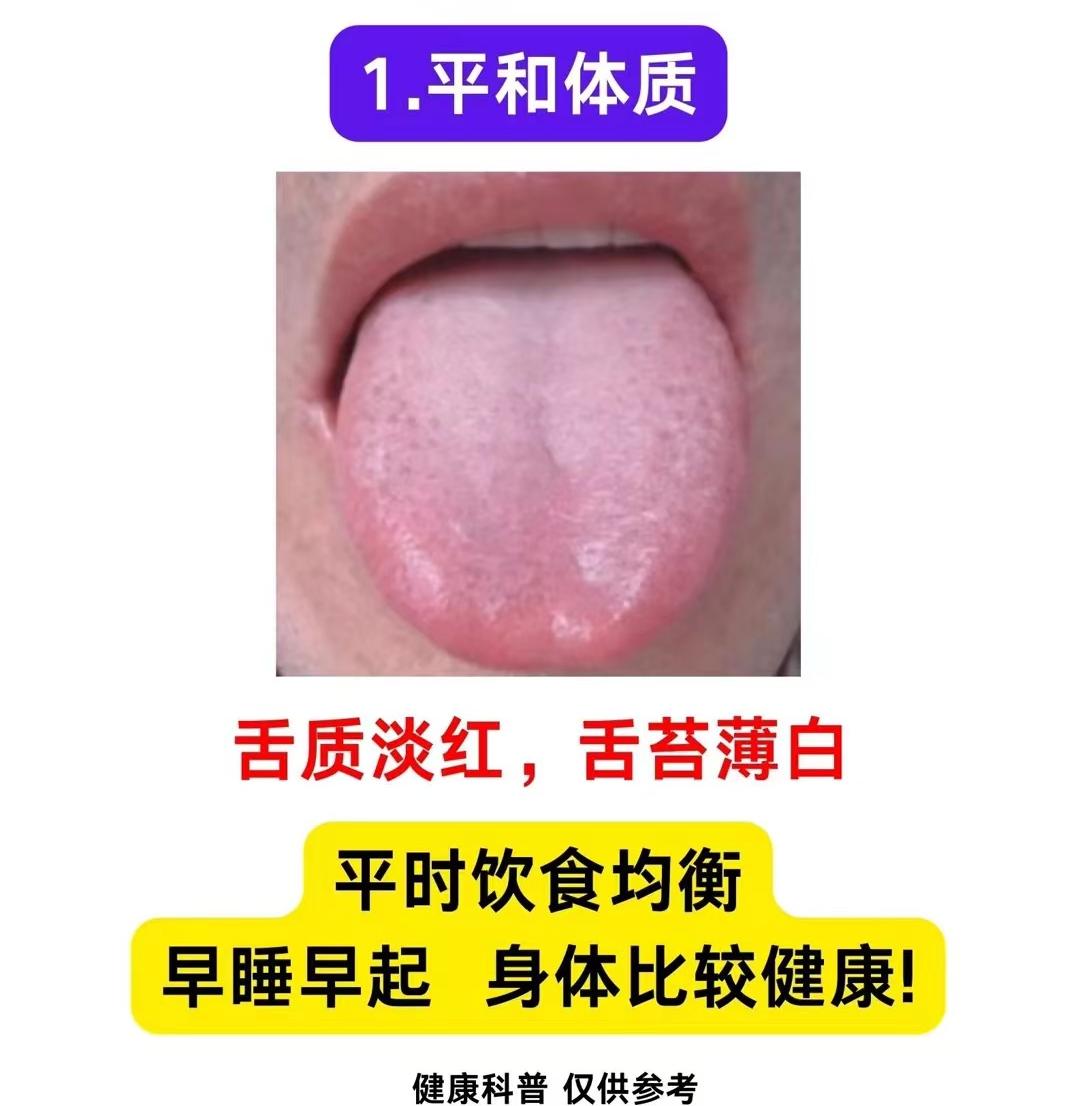 不管性别！不管男女！人分为9种体质，你知道自己属于哪一累人吗？
潘医生絮叨几句：