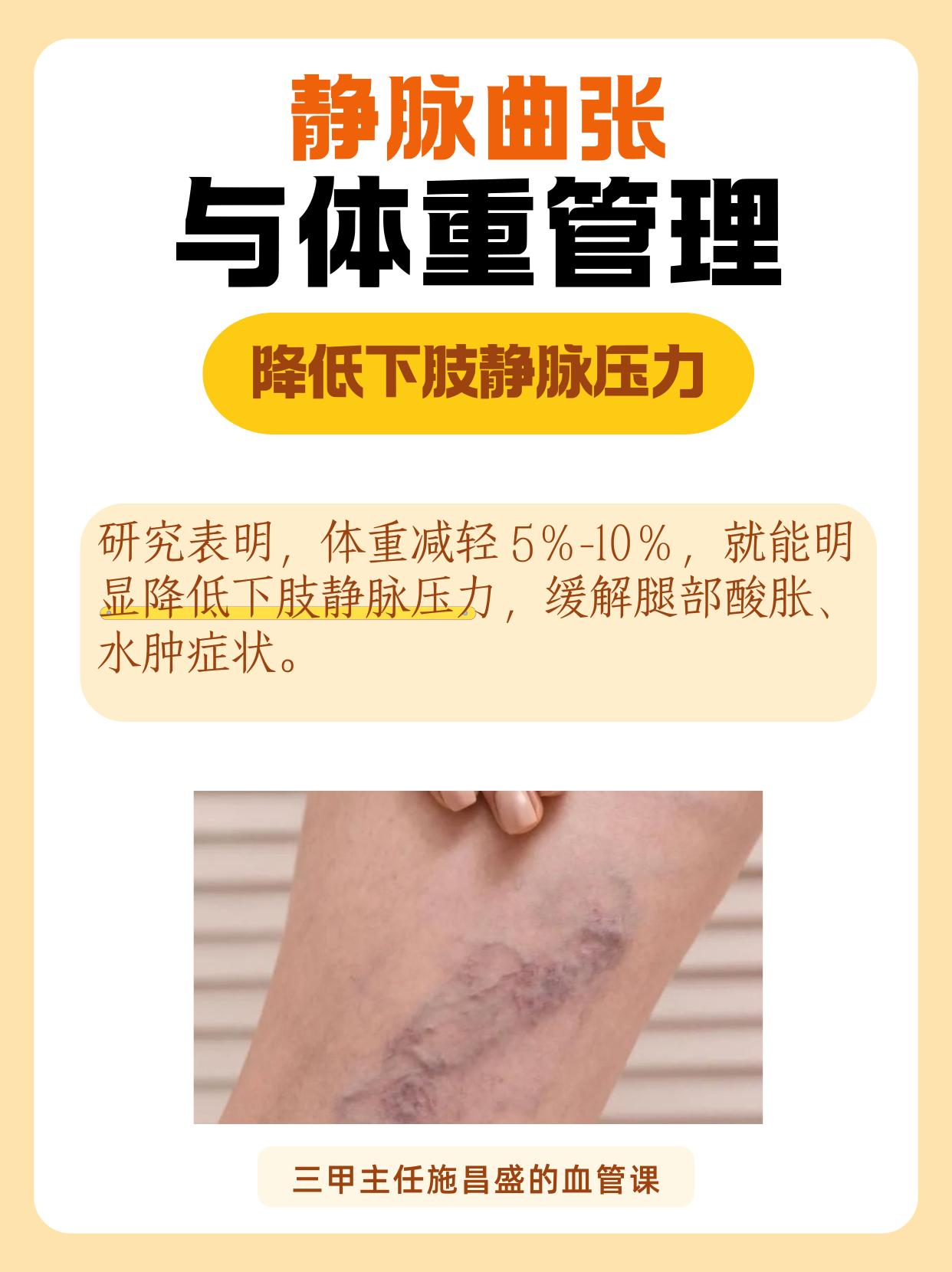 静脉曲张与体重管理。体重管理是静脉曲张重要干预手段，减重效果有明确参考。