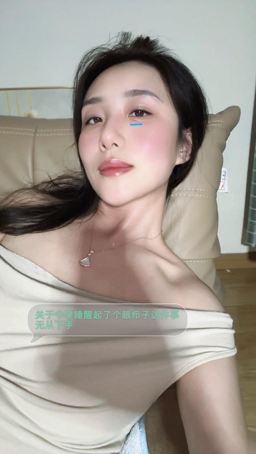 眼疖子怎么治？？？关于今早睡醒起了个眼疖子这件事
无从下手