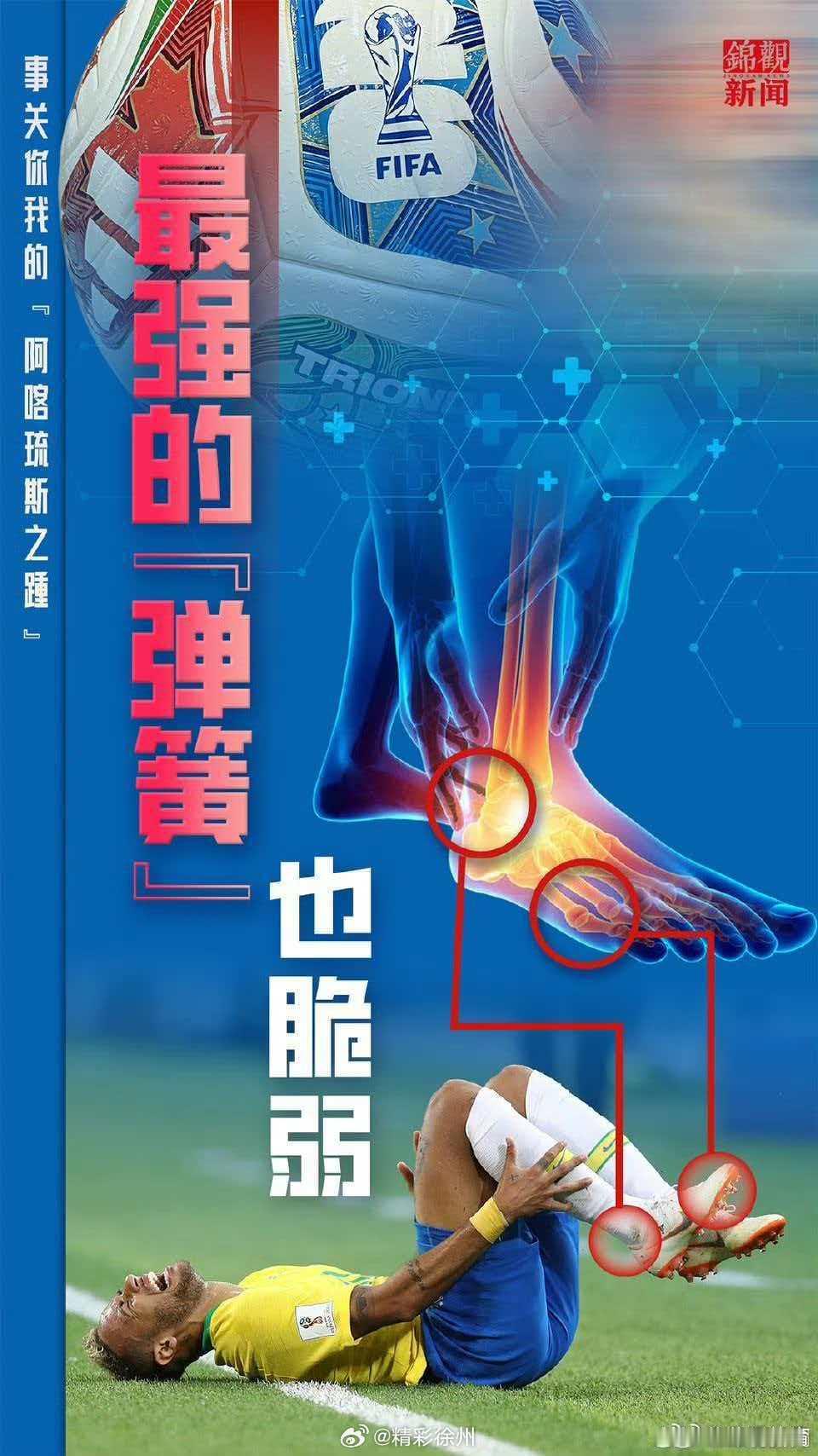 伤病阴云笼罩世界杯诸强距离2026年美加墨世界杯揭幕仅剩数天，阿根廷、巴西、西班