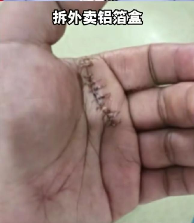 江西南昌。一男子点了份外卖，外卖是铝箔盒子包装，男子一拆，左手被划伤，男子急了，