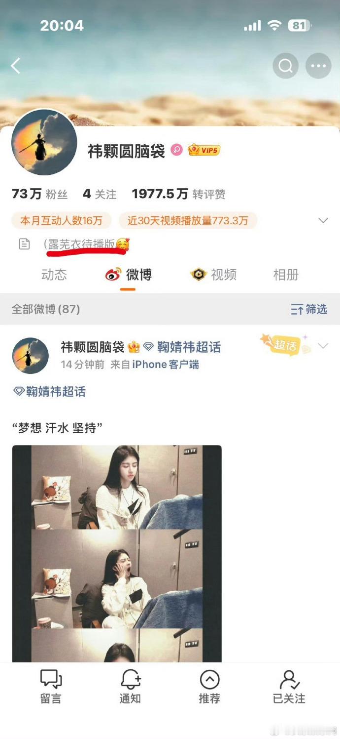 鞠婧祎露芜衣待播版月鳞绮纪鞠婧祎田嘉瑞人设更好演员与角色高度契合，人设设定加分，