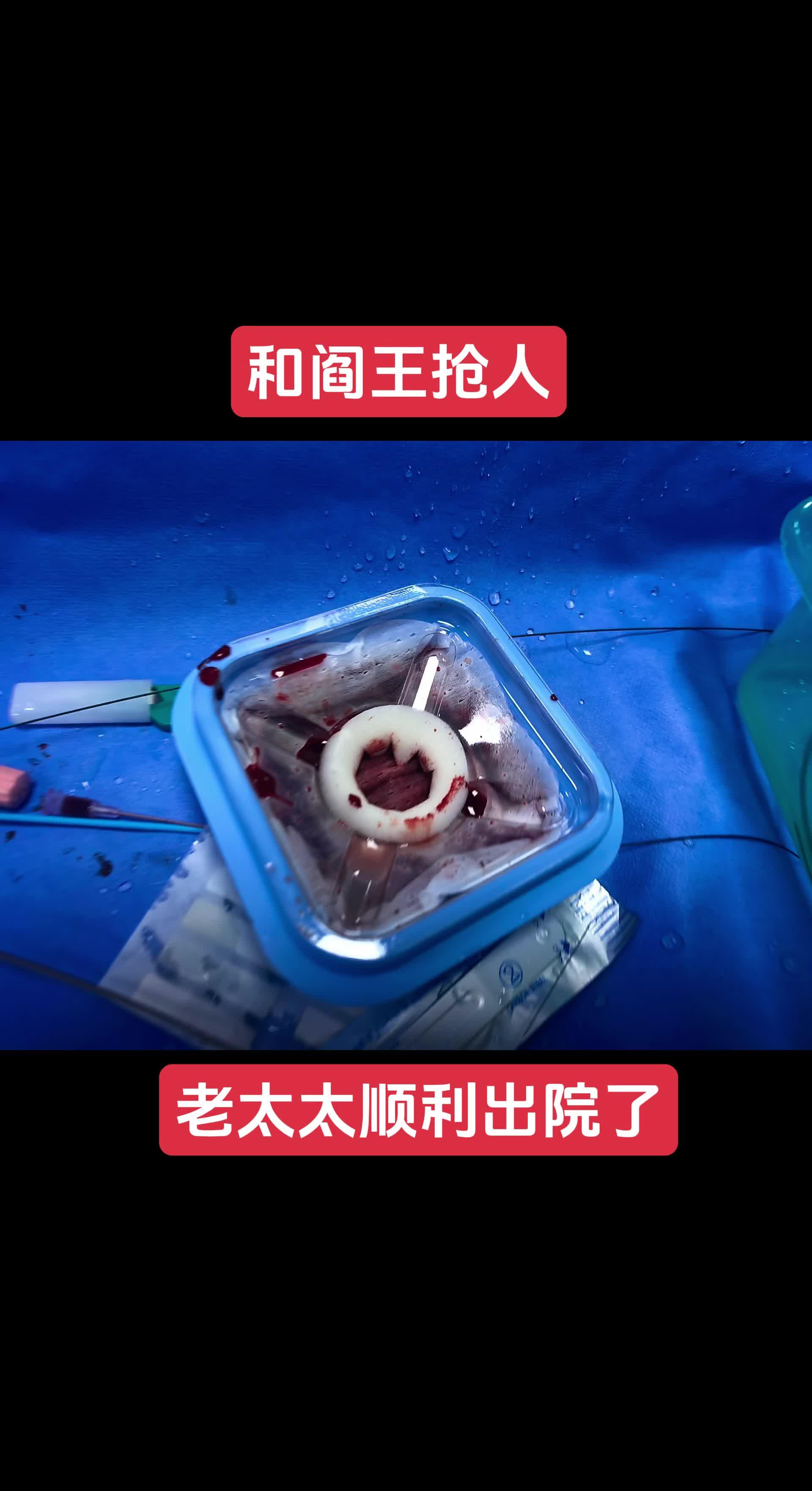 老太太很坚强，我们医生也很努力 老太太急性心肌梗死多日入院，呼吸急促...
