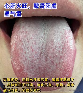 今日舌诊案例分析：湿热、气阴两虚、上热下寒、心肝火旺