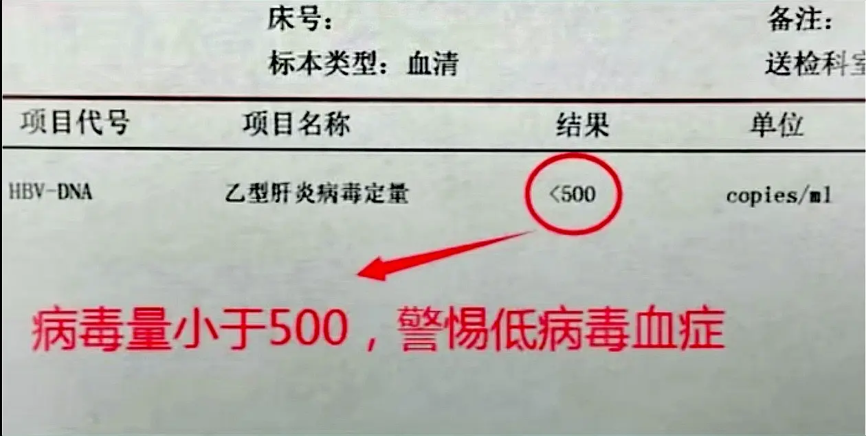 乙肝服用抗病毒药物2年以上，一定要警惕低病毒血症！ 检测HBV-DNA...