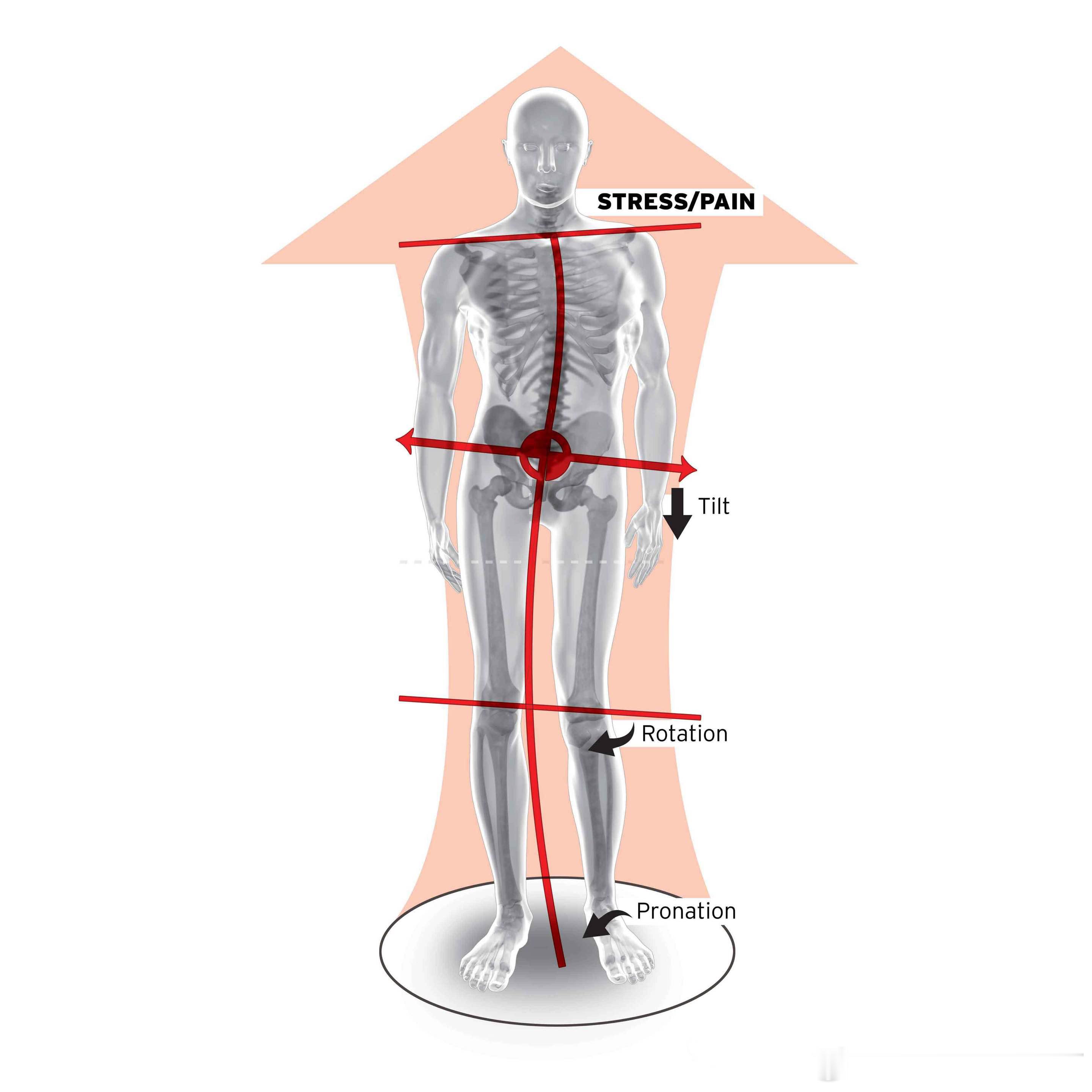 #腰痛# 【康复科普】很多人的单侧腰痛、脊柱侧弯、肩颈不适，在线下初诊中发现，一