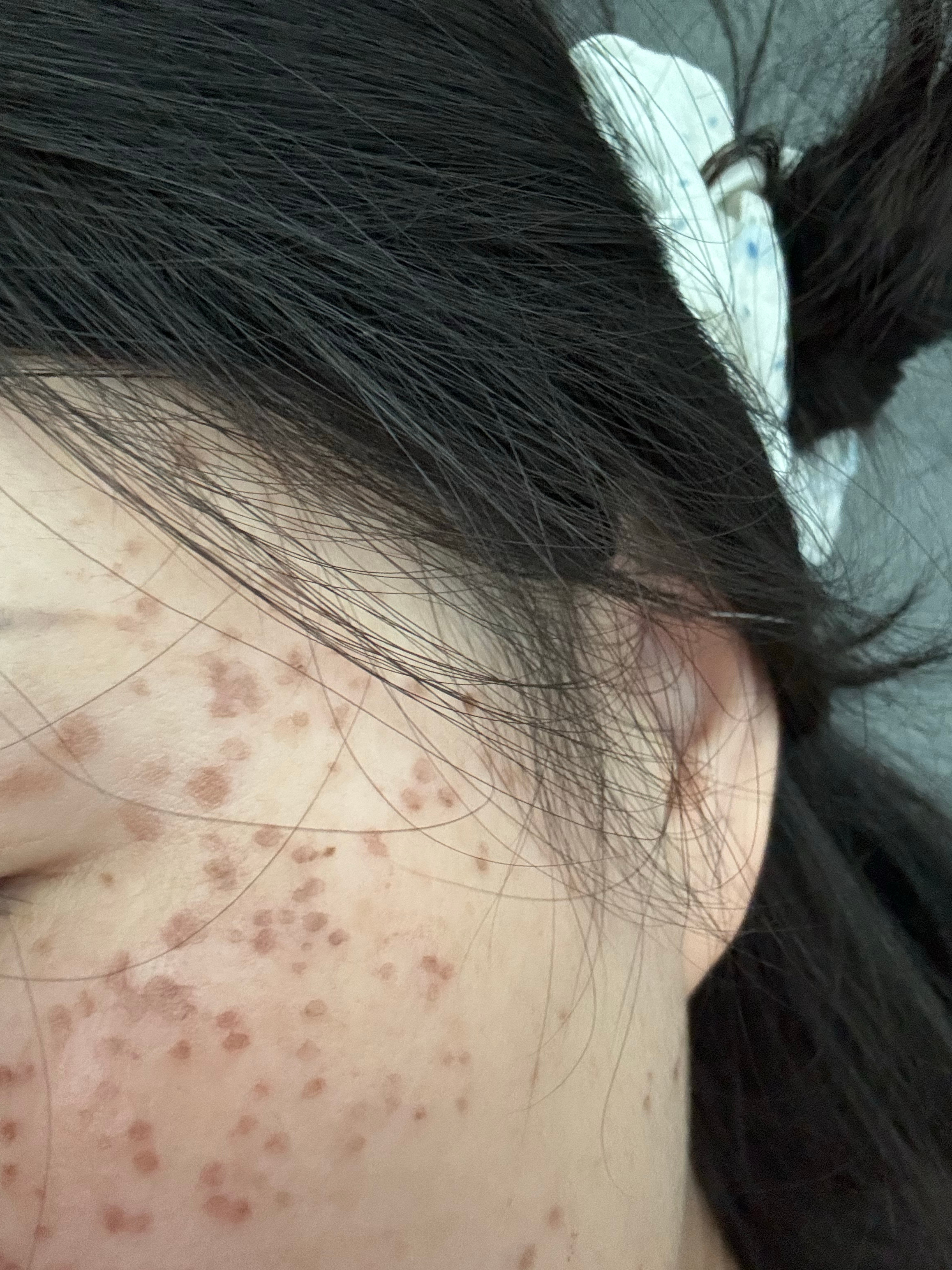 女人为了爱美也是下狠手了