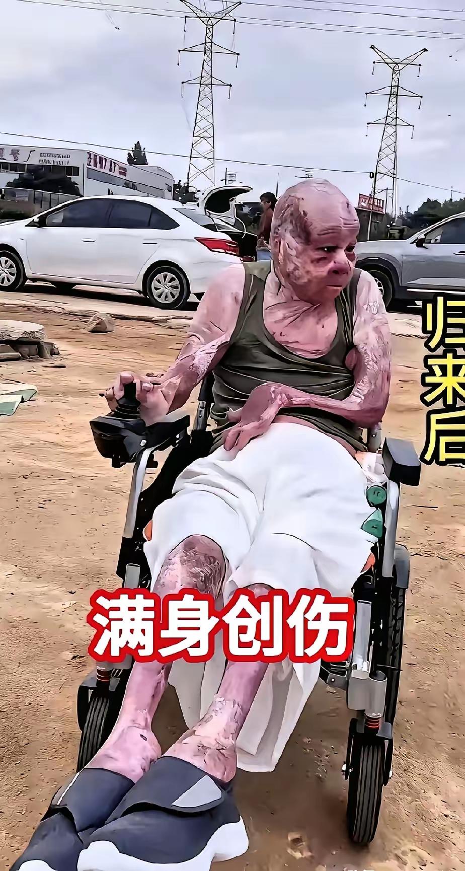 泪目了！
相信不用说你也知道，
这个曾经帅气的小伙，
是一名消防员。
他的父母得