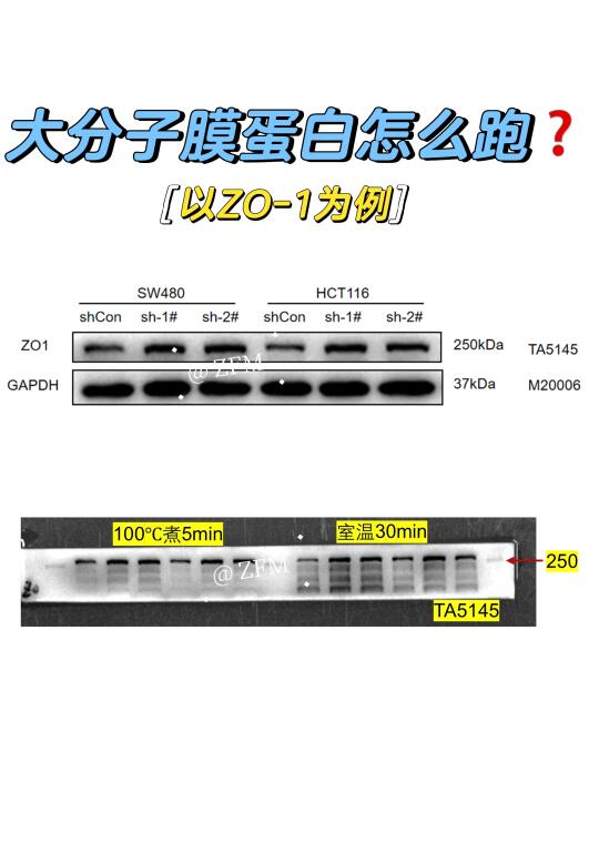 大分子膜蛋白怎么跑❓（以ZO-1为例）