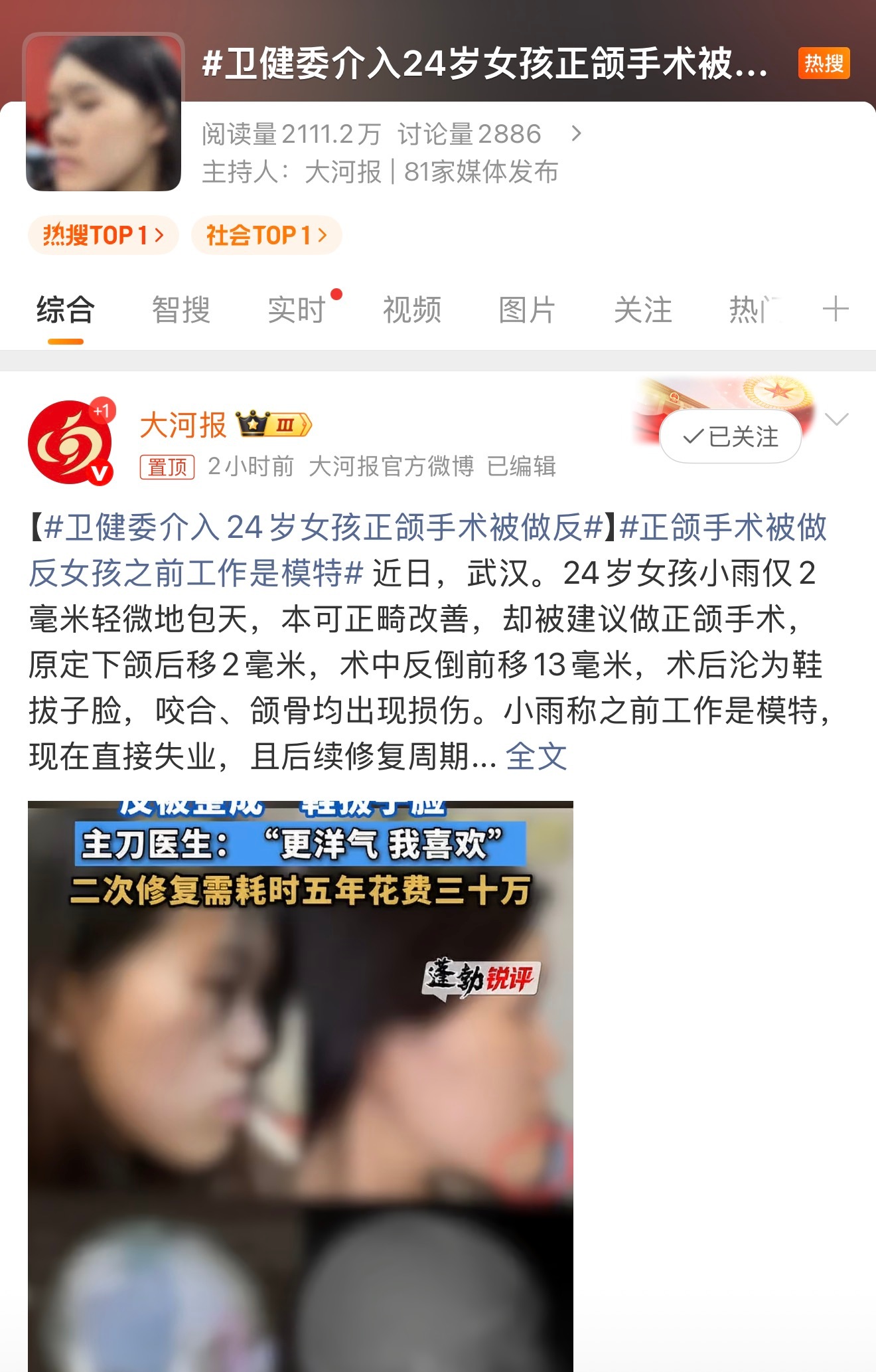 卫健委介入24岁女孩正颌手术被做反正颌手术它和做双眼皮、隆鼻还不一样，它属于四级