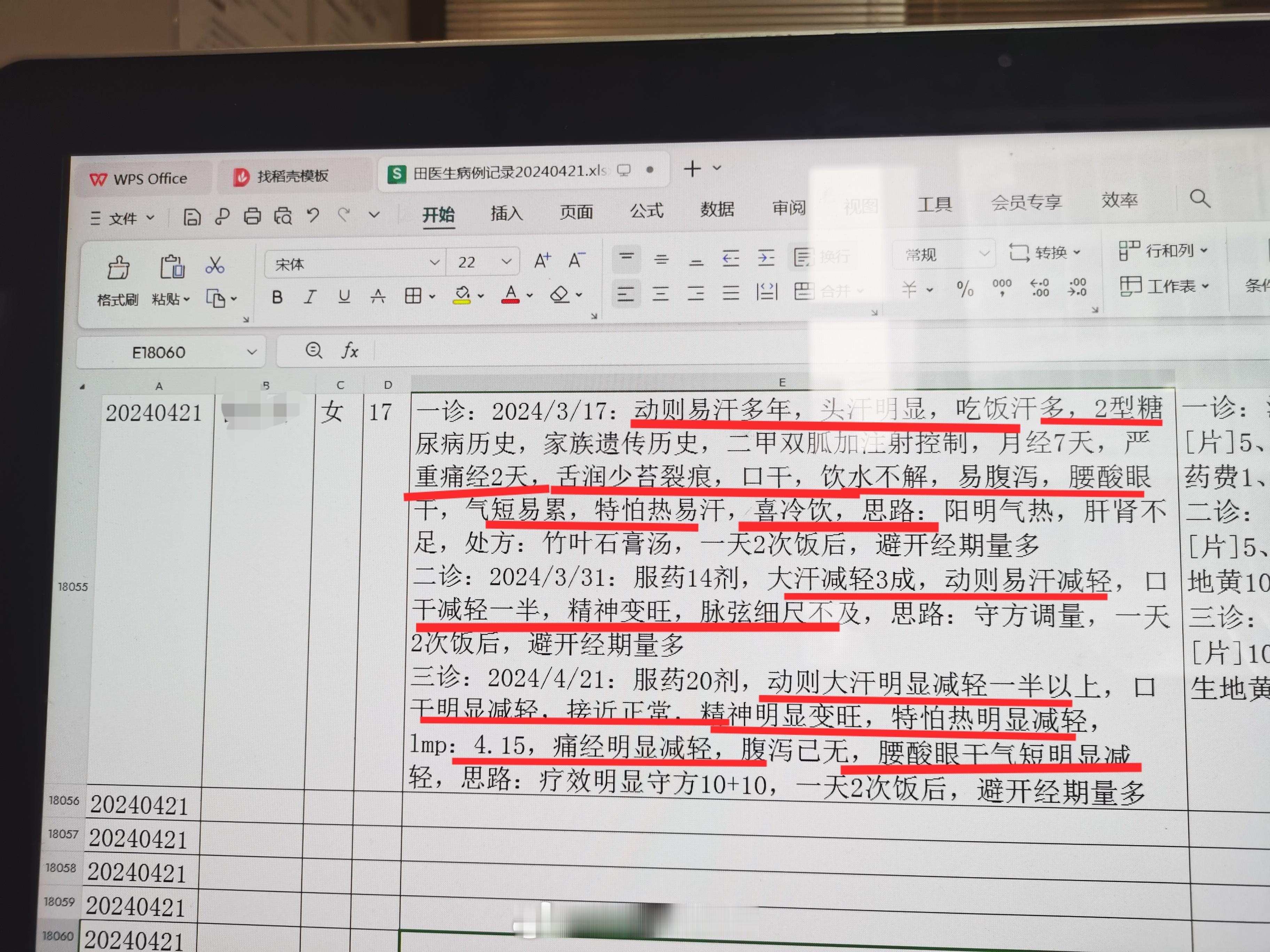 #中医##多汗症#  发点冷门案例  17岁美女 动则多汗大汗淋漓多年，3月武汉