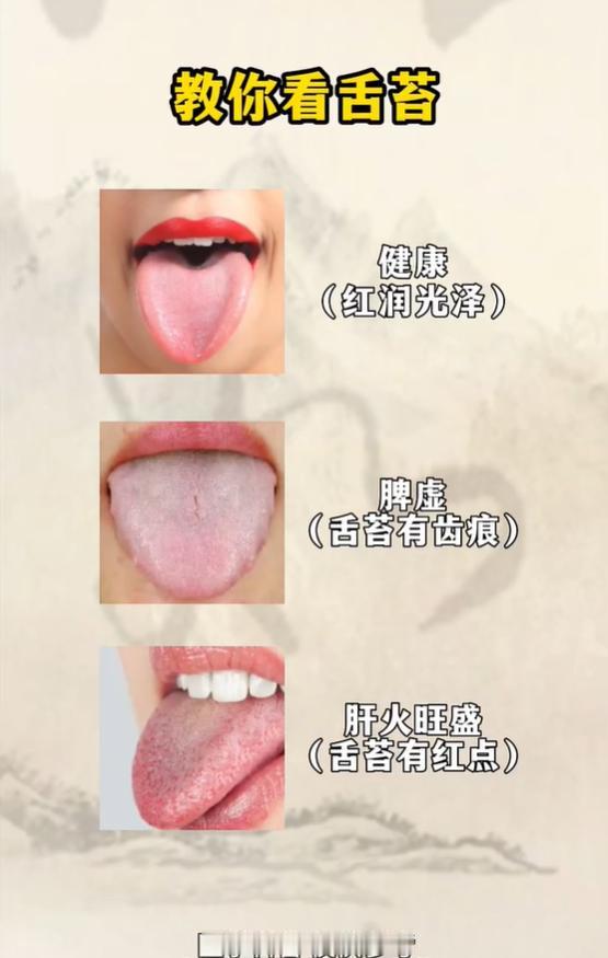 教你看舌苔，6 种常见舌象对应不同体质
