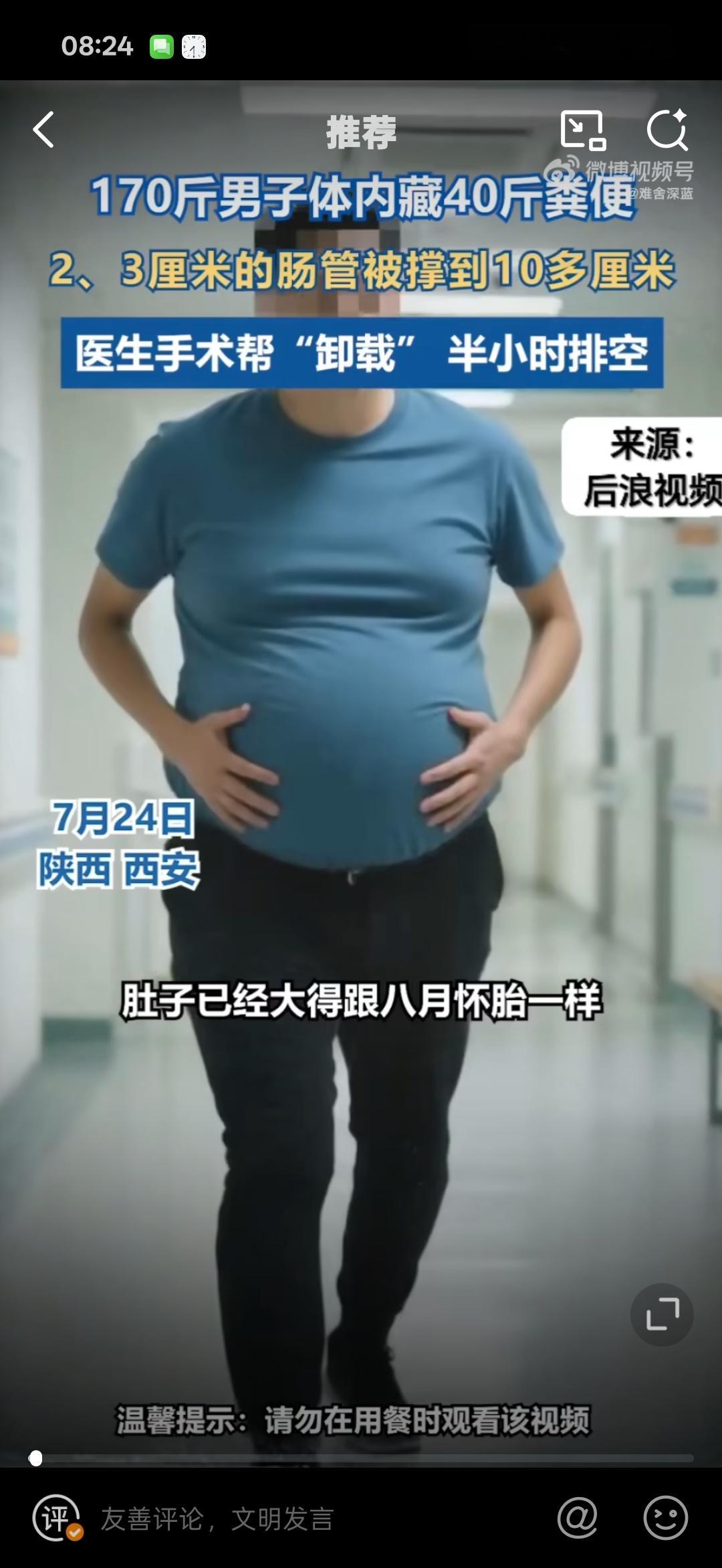 男子体内藏40斤粪便体型像青蛙这几张对比照片可以拿来做减肥药广告了，我靠[揣手]