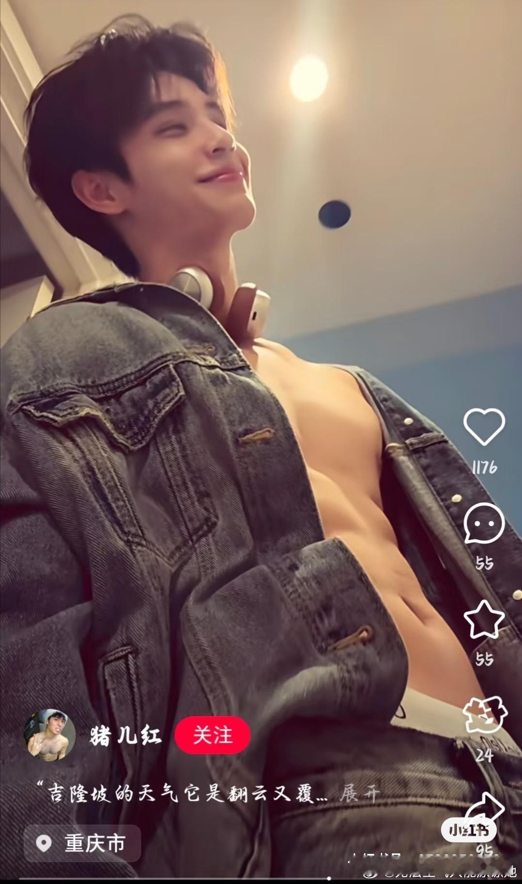 颧骨靠前 颧骨靠后 