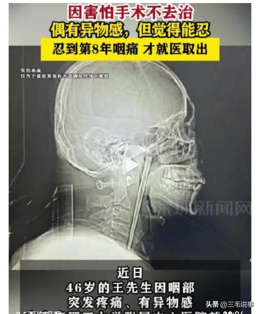 我的天呐，如果不是在网上所见，我是万万不敢相信竟然还有这种事。

3月12日热搜