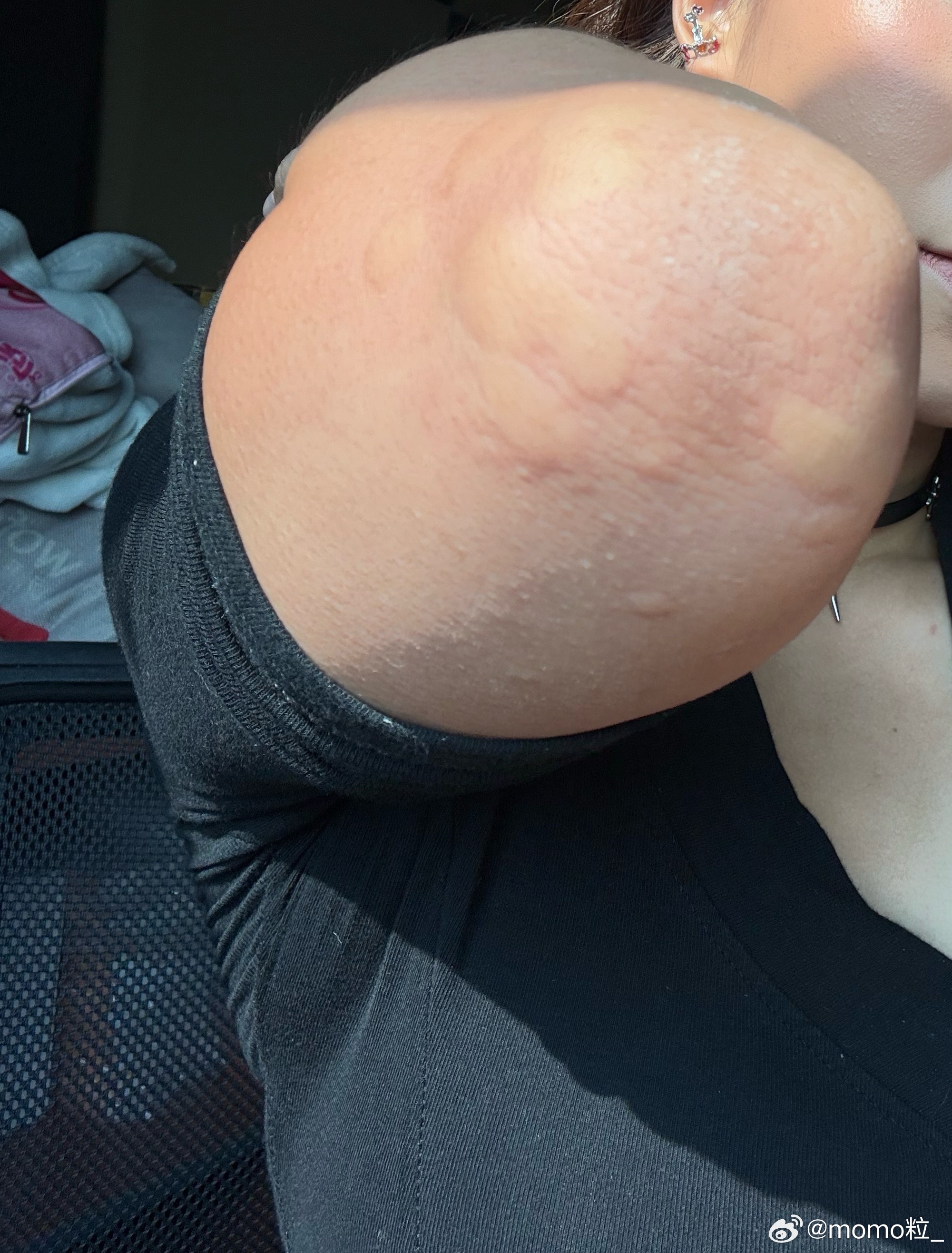 广东蚊子 抗药性[开学季]深圳蚊子真是啥也不怕，花露水、蚊香、驱蚊液都防不住在户
