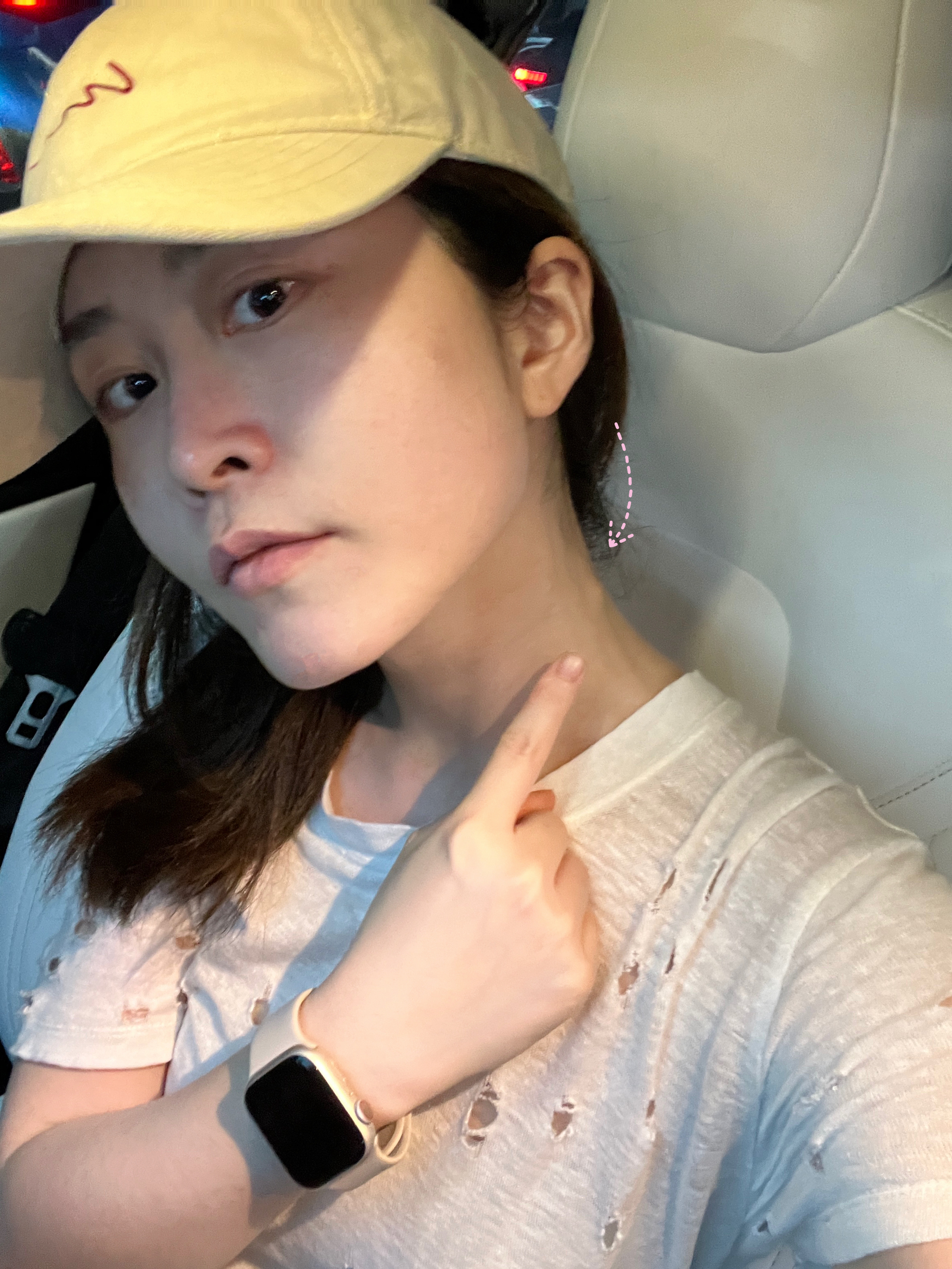 姐妹们 我好慌啊[可怜][可怜][可怜]脖子侧面突然长了个这样的硬包[可怜]摸起