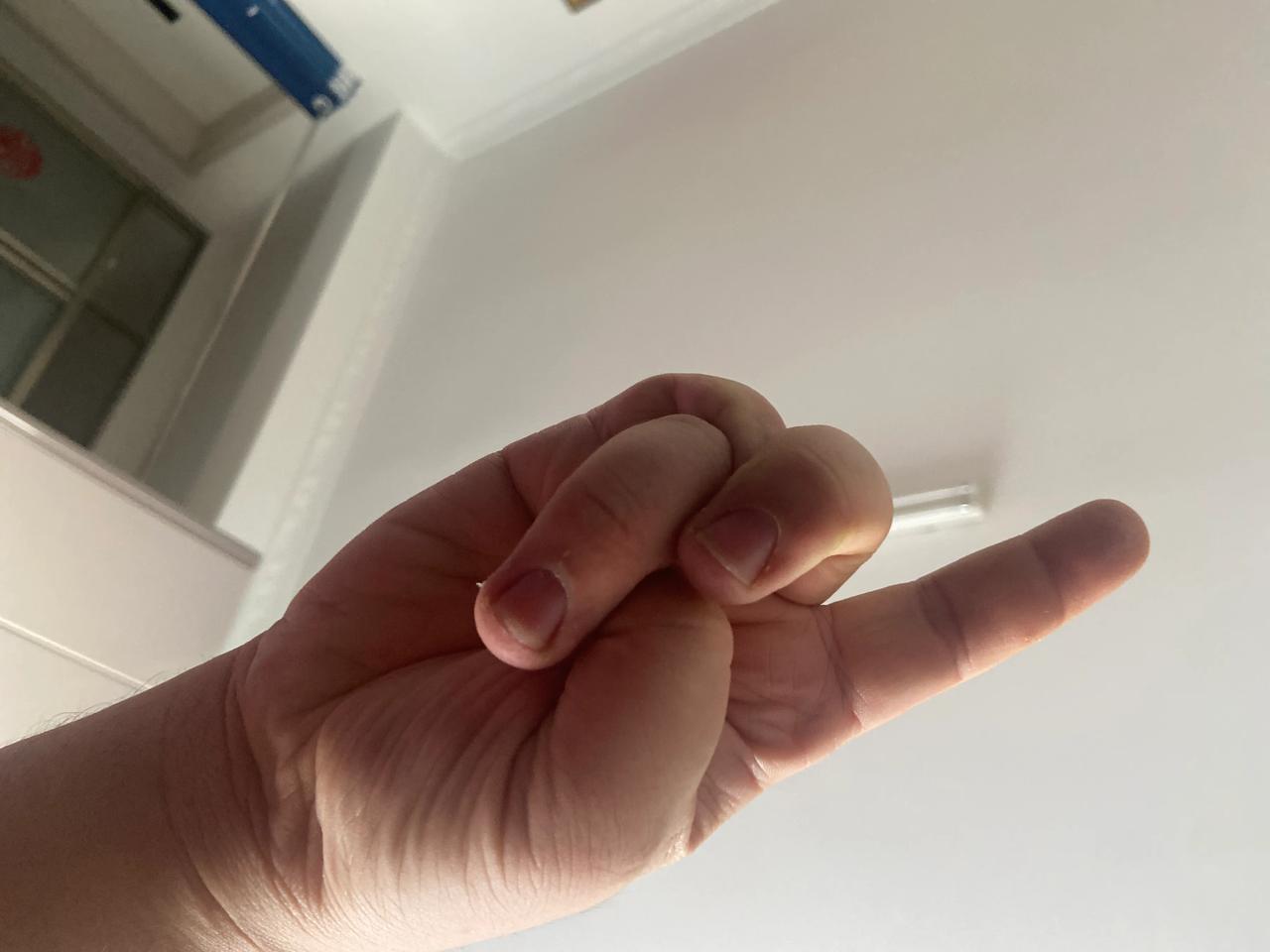 一、基础玄天指（玄天印）

1. 先将大拇指弯曲，指尖抵住无名指的根部（指节处）