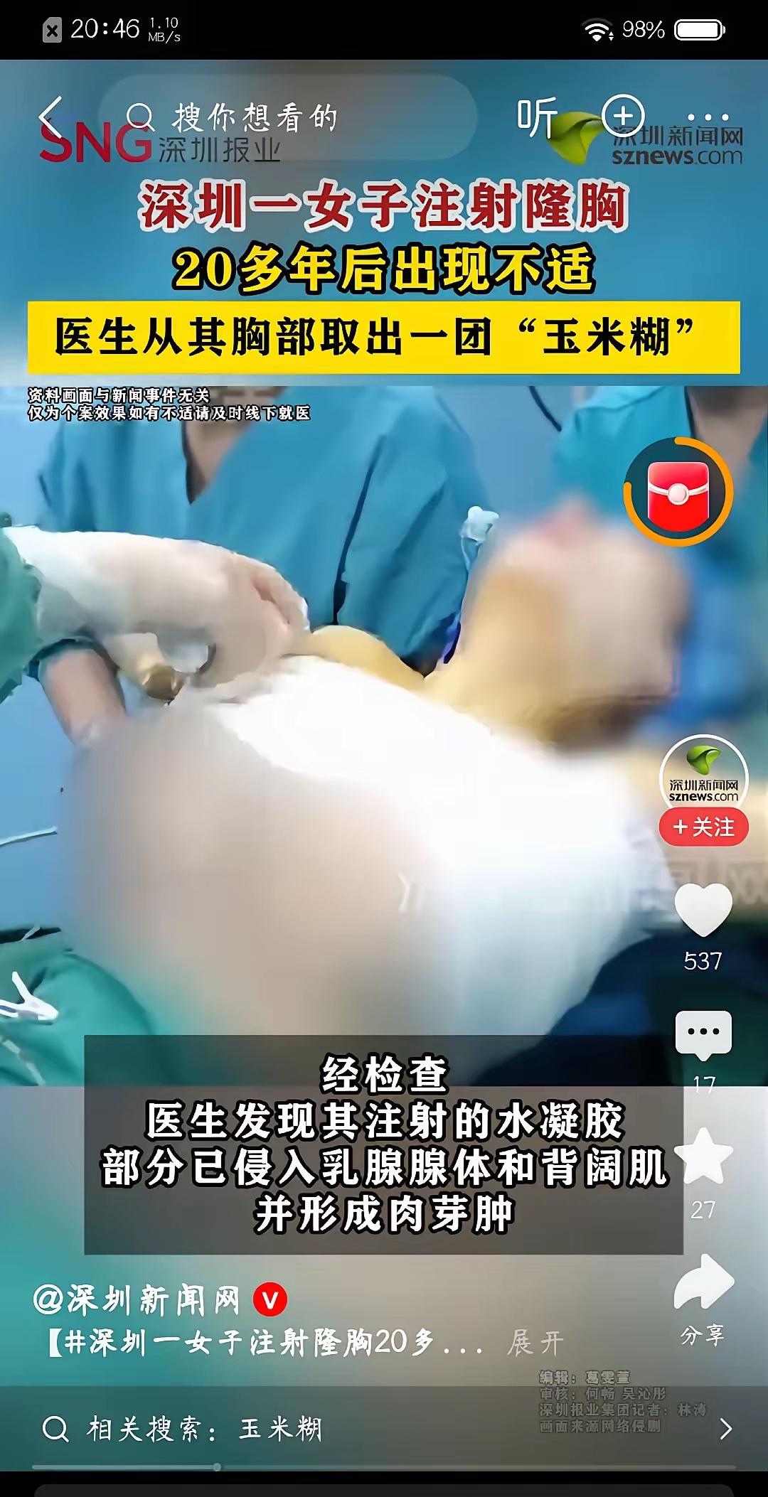 “太吓人了！”深圳，一48岁女子在而是年前听信广告宣传，接受了注射隆胸手术，如今