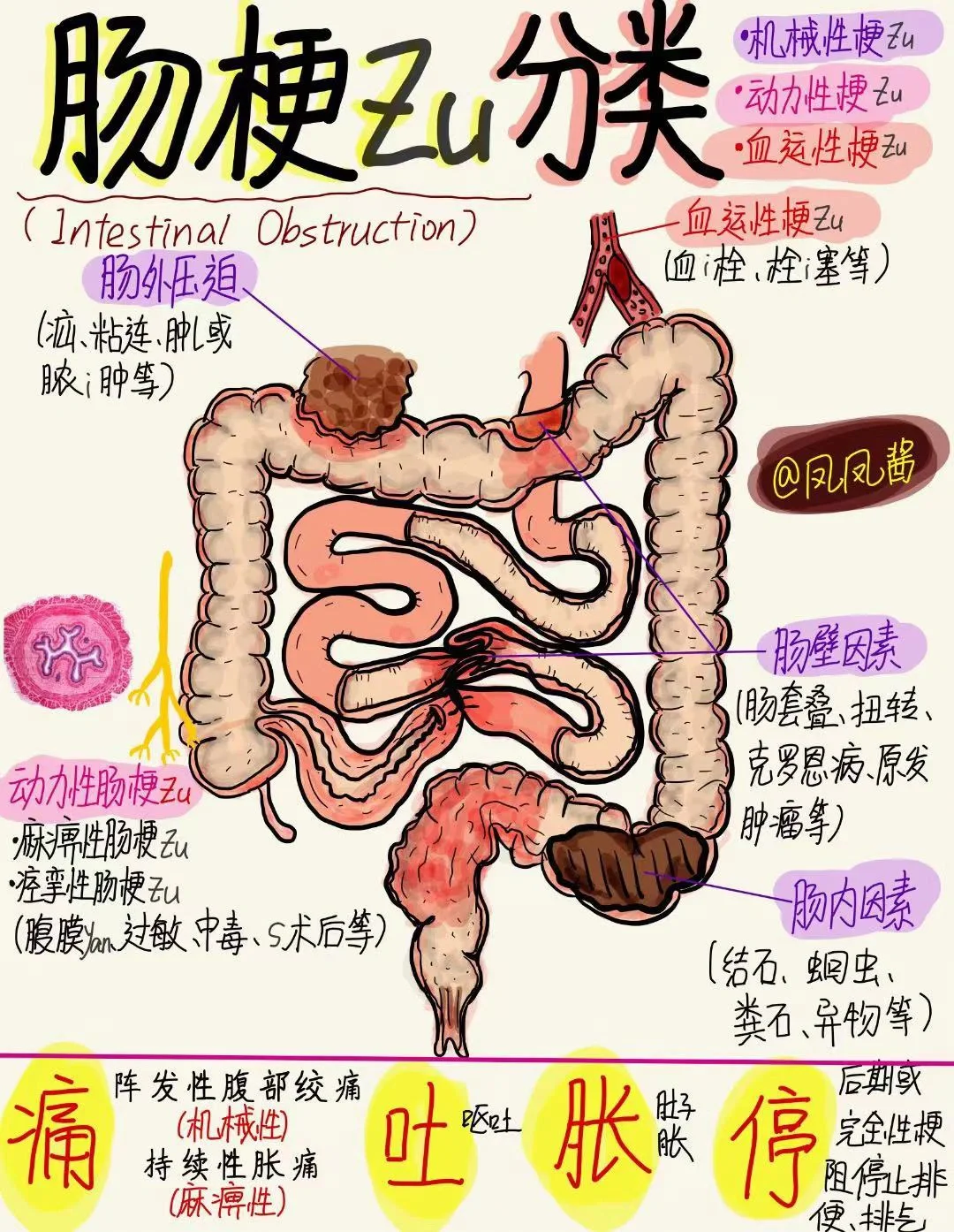 📖手绘笔记 |肠梗z分类 建议点赞收藏