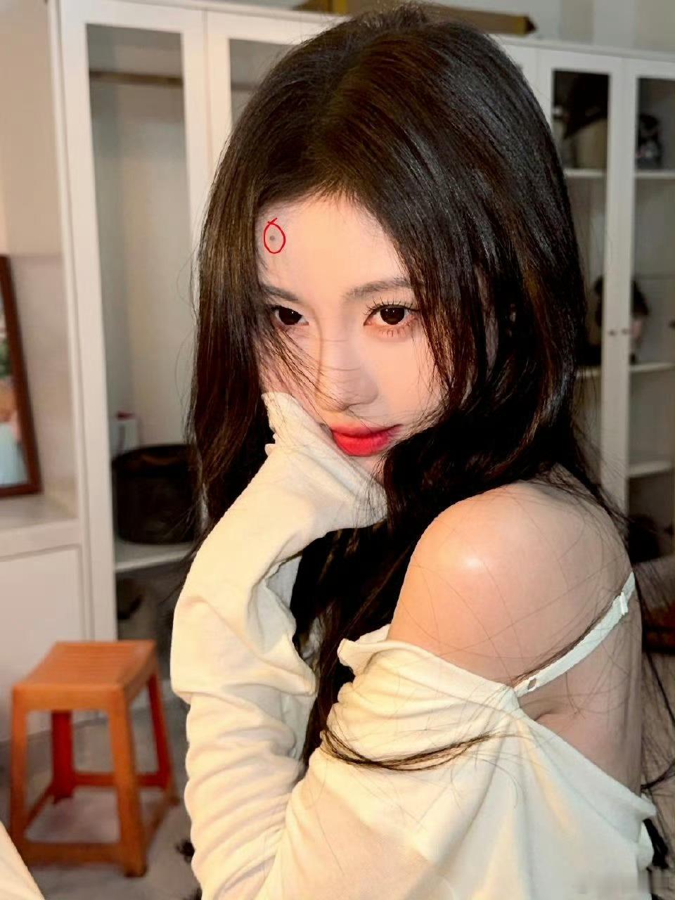 鞠婧祎额头受伤 伤口还挺明显的，还好第一时间处理好了，不然可能会留疤，还是得小心