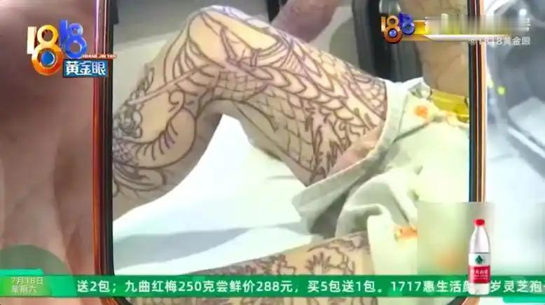 14岁的孩子，暑假刚到杭州与母亲团聚，转眼却把2条腿纹成了“大花腿”。母亲原本盼