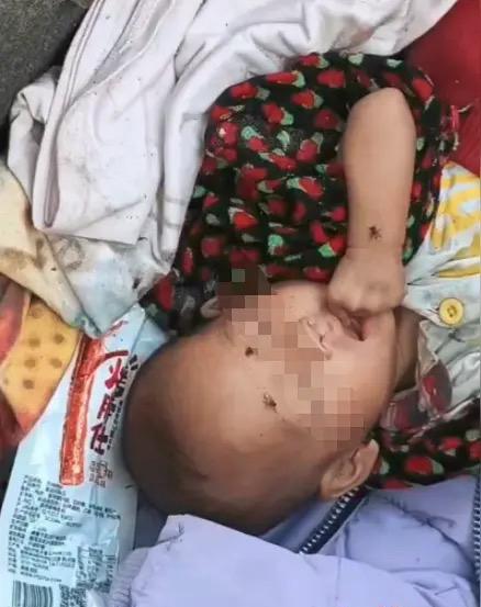 爷爷把没烧完的酒精燃料当开水喂给孙子，孩子一口下去甲醇中毒差点没命。
爷爷带着孙