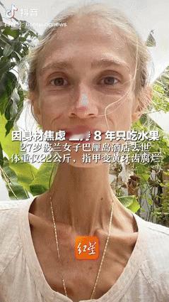 “代价太大了！”10月6日波兰女子从19岁开始坚持8年只吃水果，亲朋好友劝说却都