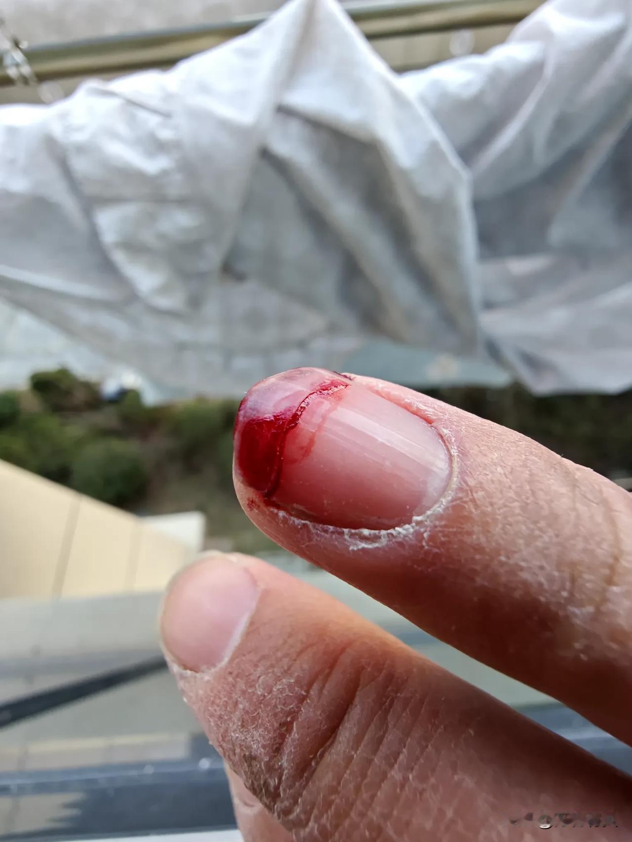 收被子要小心！我自己免费做了个美甲！被子上线划破了指甲，疼死我了[流泪][流泪]