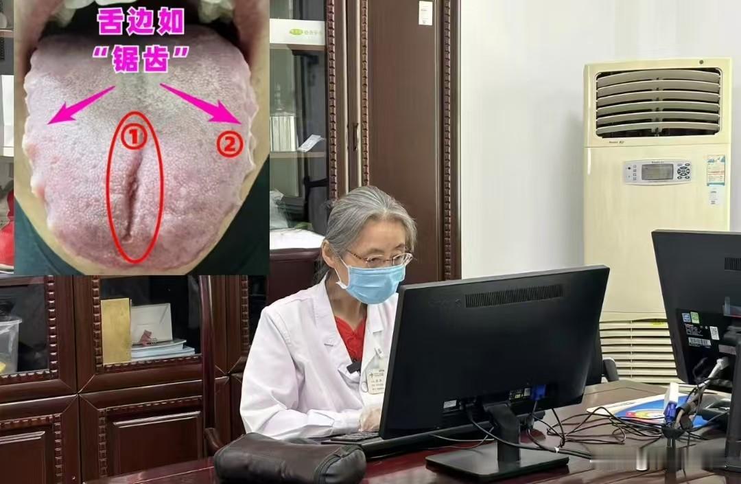 这种齿痕舌看似复杂，其实也好调理！

患者主诉：男科不行，口干口苦，脾气暴躁，四