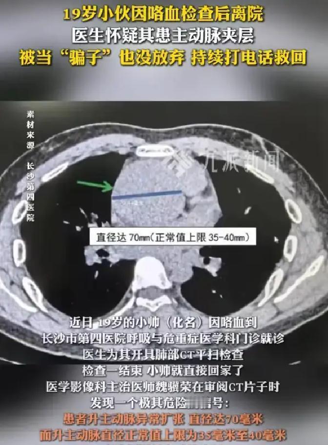 湖南长沙，19岁小伙小帅在家里突然咯血，心里发慌就赶到医院做检查，拍完CT后没等