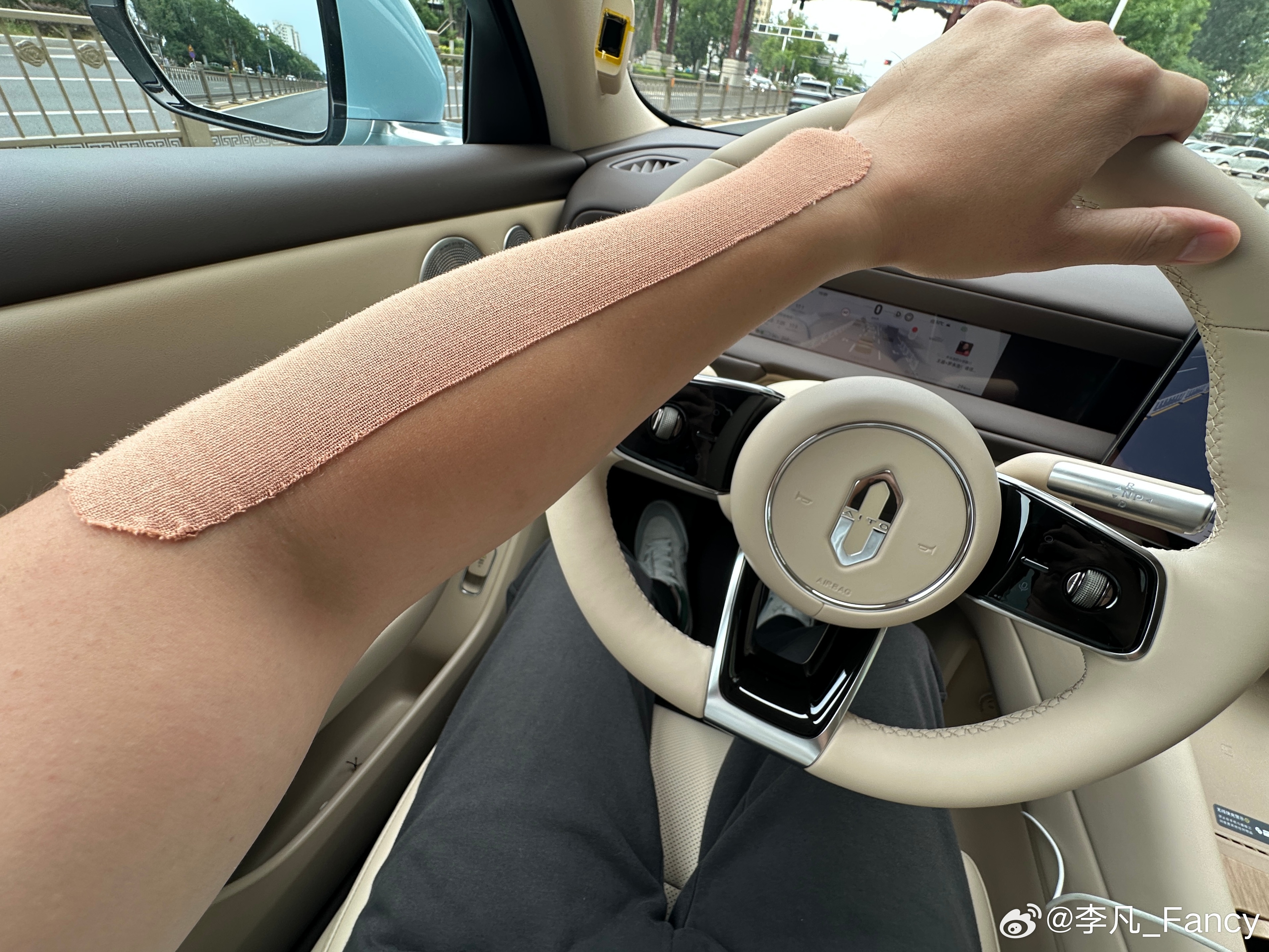 胶带真是个好东西～赛车撞了就是大力胶…胳膊坏了也胶带… 北京