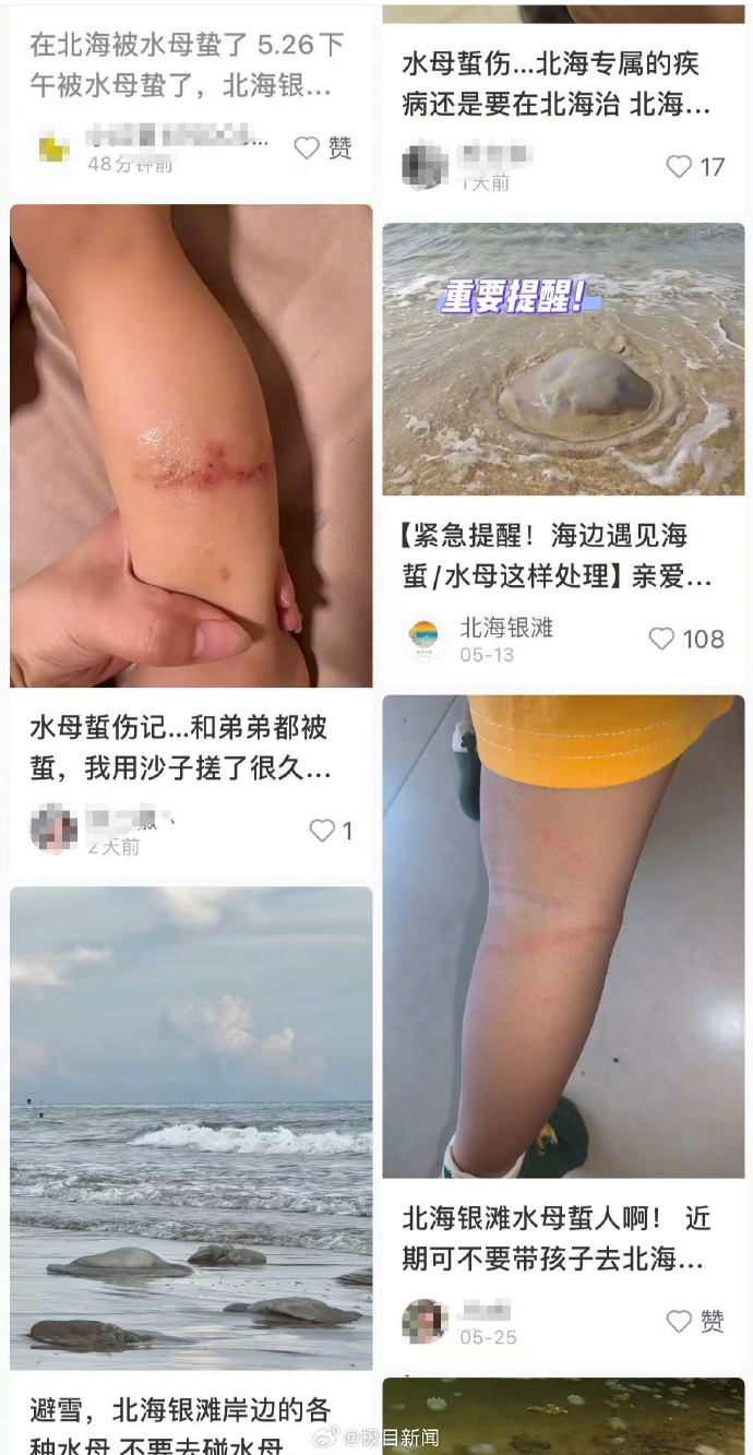 【#游客在北海游泳时被水母蜇伤#，景区：水母慢慢少了，被蜇后及时前往医务室】5日