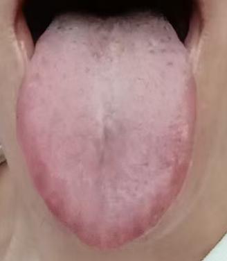 常年潮湿痰多多梦，补肾不祛湿，再怎么调理都没用







近期一位中年粉丝留